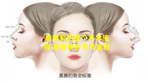 磨眉骨的整个手术流程 眉骨骨折手术流程